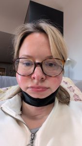 honest review of jawtite